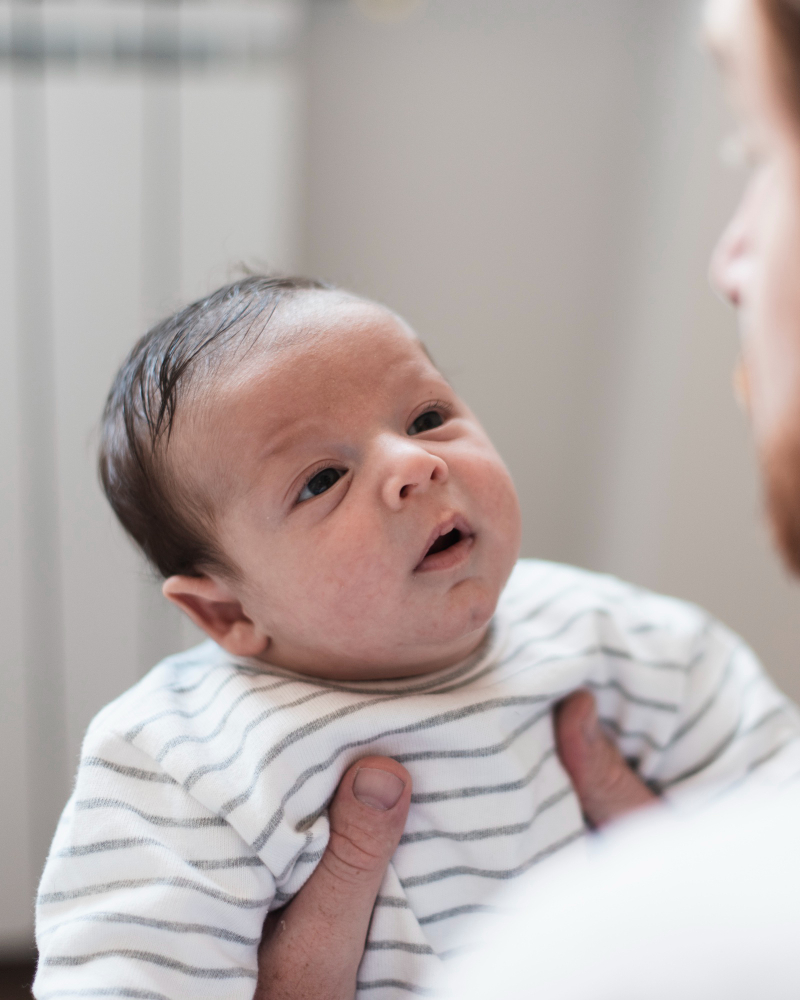neonato con pelle disidratata tenuto in braccio