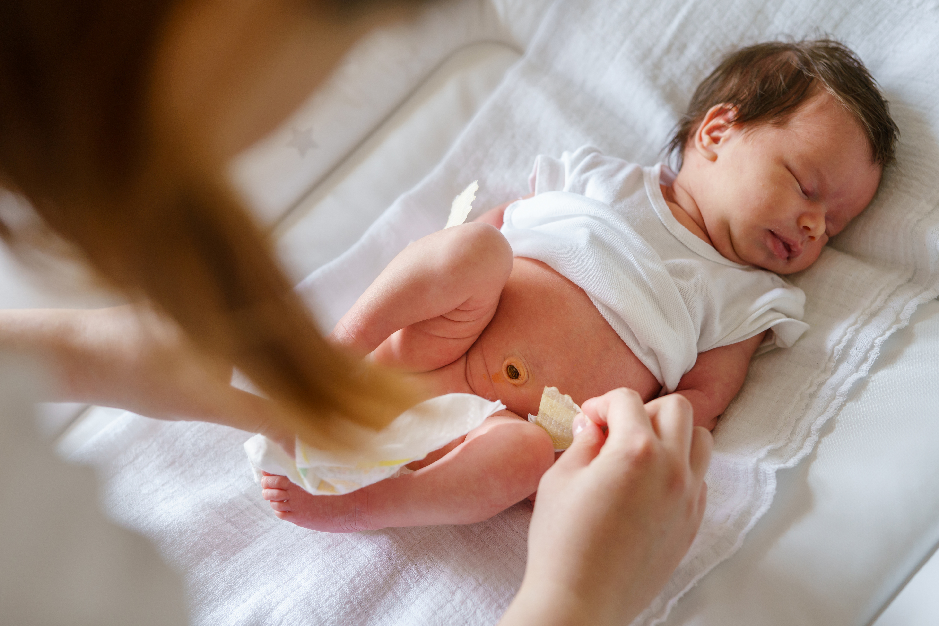 cura cordone ombelicale neonato