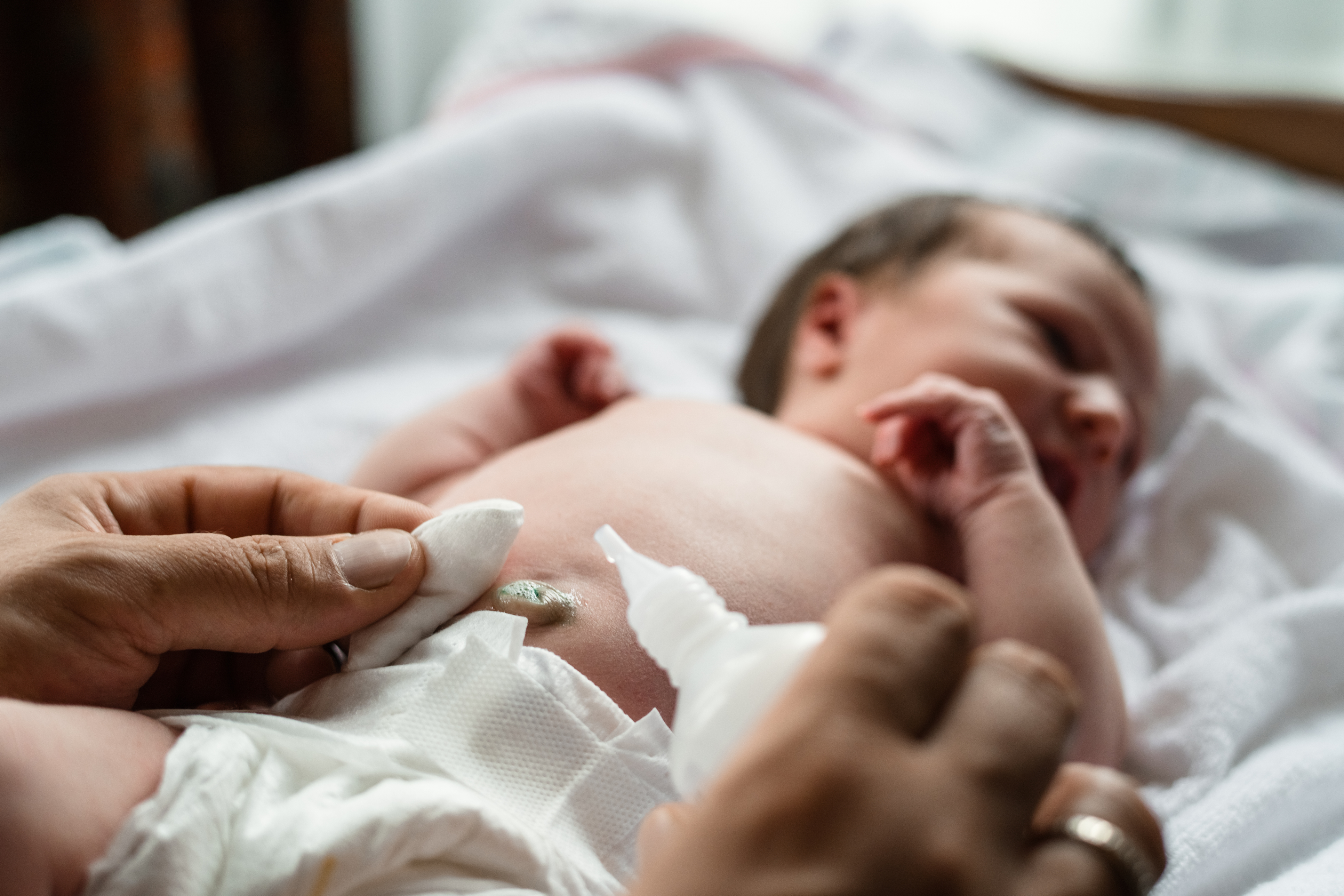 cordone ombelicale neonato