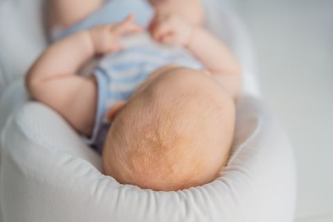 neonato con crosta lattea che dorme