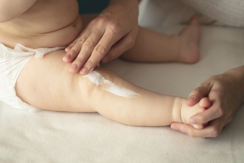 neonato con pelle screpolata